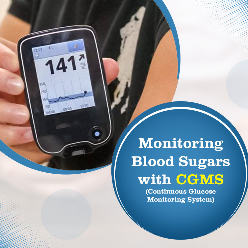 Monitoring  Blood Sugars with CGMS (Continuous Glucose Monitoring System)